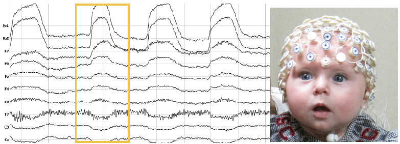 CVPR 2017论文精选#3 不可思议的研究: EEG脑电波深度学习在视觉分类中的应用
